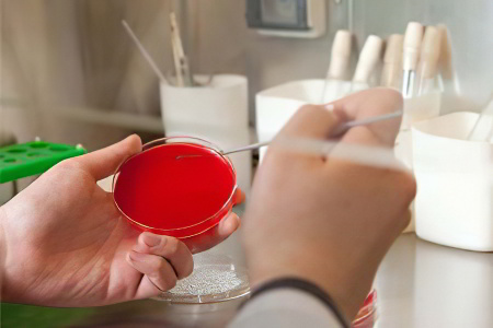 Методы диагностики туберкулеза