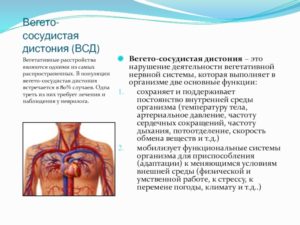 Метеочувствительность при ВСД (вегето-сосудистой дистонии)