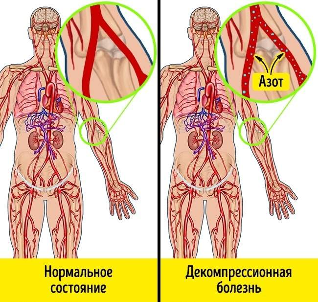 пониженное атмосферное давление влияние на человека с повышенным давлением