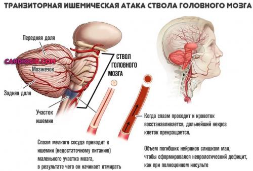 Влияние атмосферного давления на гипотоников. Влияние низкого атмосферного давления на организм 