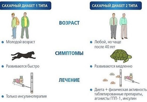 Типы сахарного диабета
