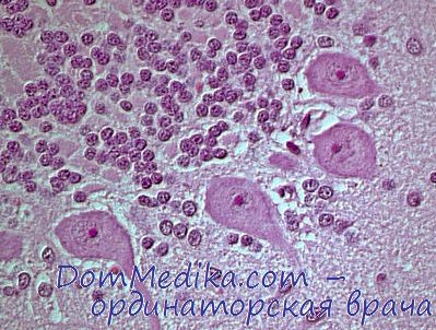 влияние погоды на сердце и сосуды