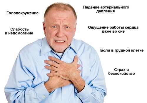 Тахикардия